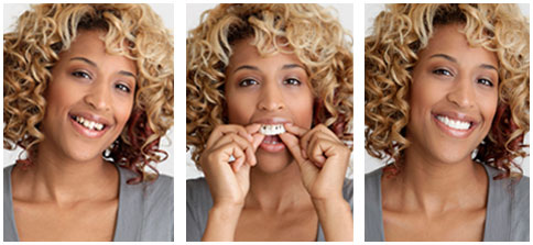 Snap-On Smile Smyrna, TN