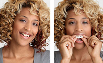 snap-on smile Smyrna, TN