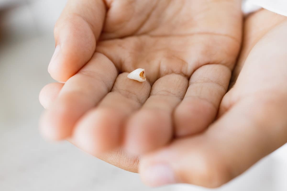 Knocked out tooth first 30 minutes