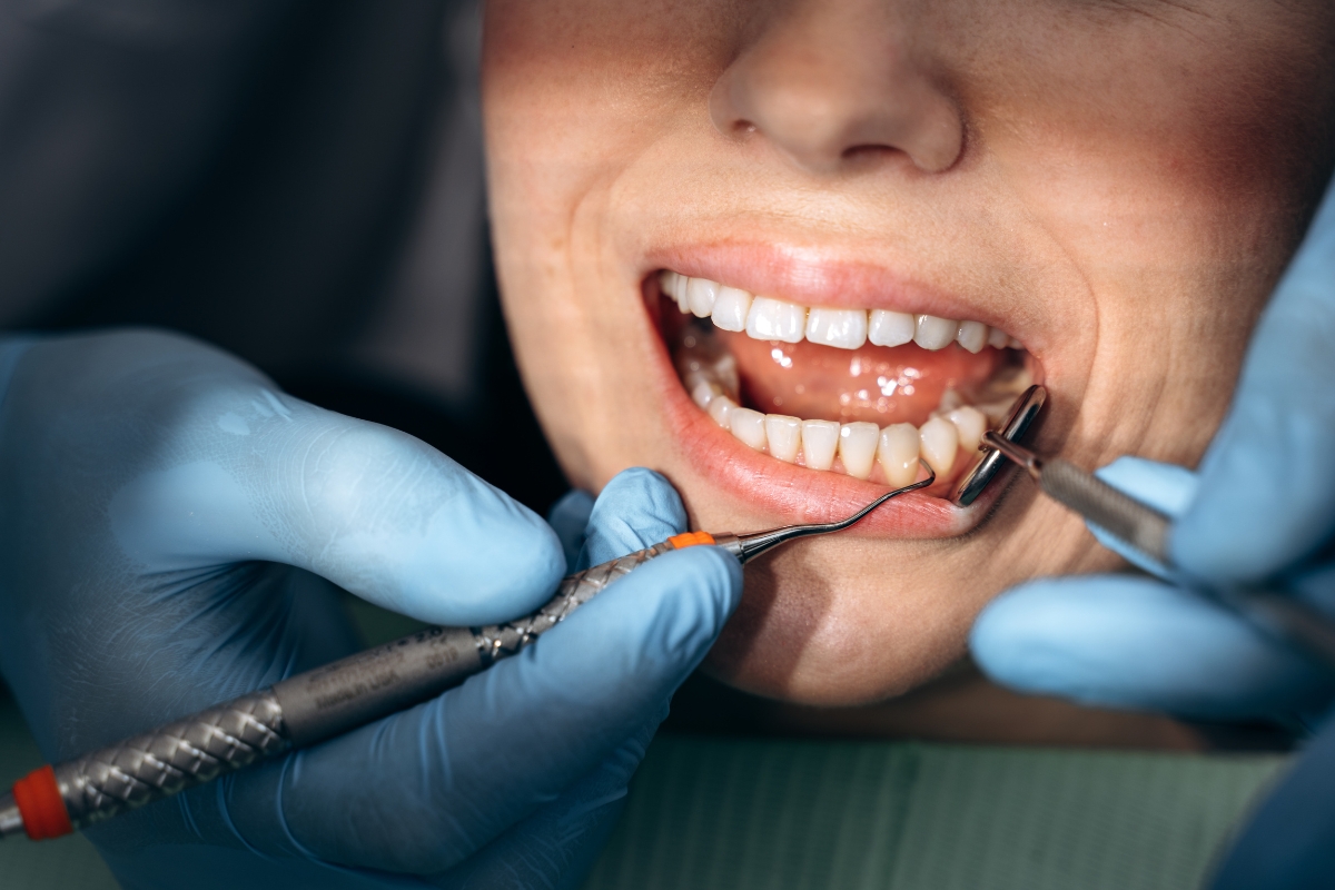 dentist in smyrna tn warns about the early signs of gum dieseses