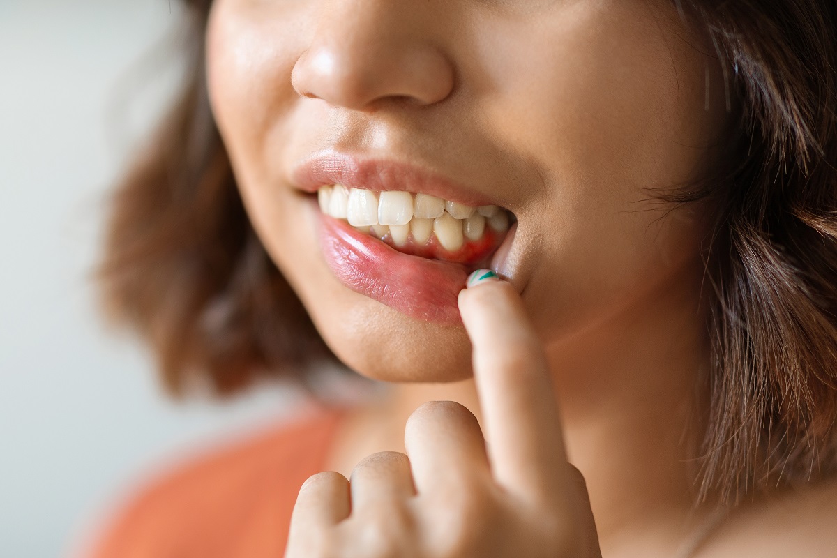 How to get rid of gingivitis