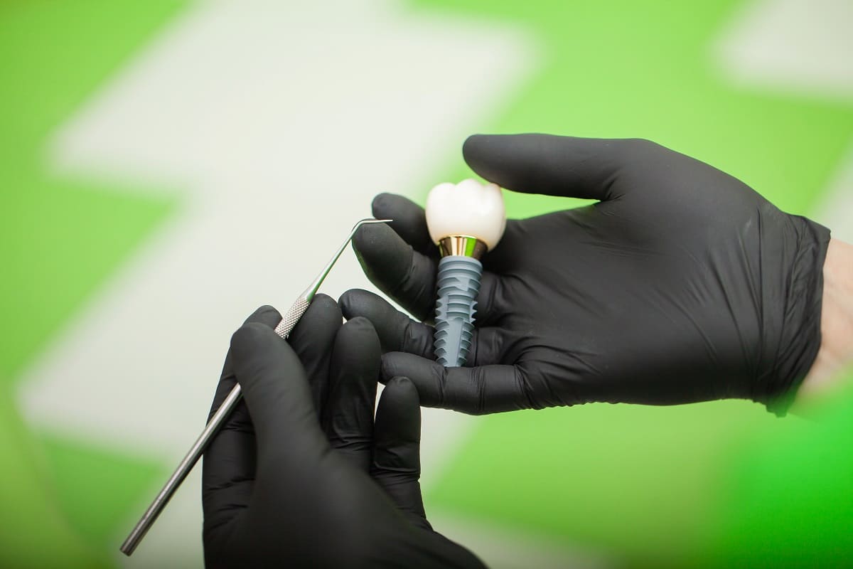 how to choose the right dentist for dental implants in smyrna tn